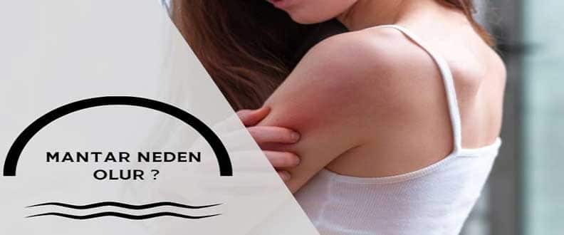 Kadınlarda Mantar Tedavisi Nedir