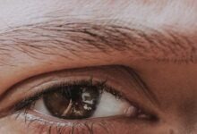 Göz Altı Torbalarını Nasıl Alınır